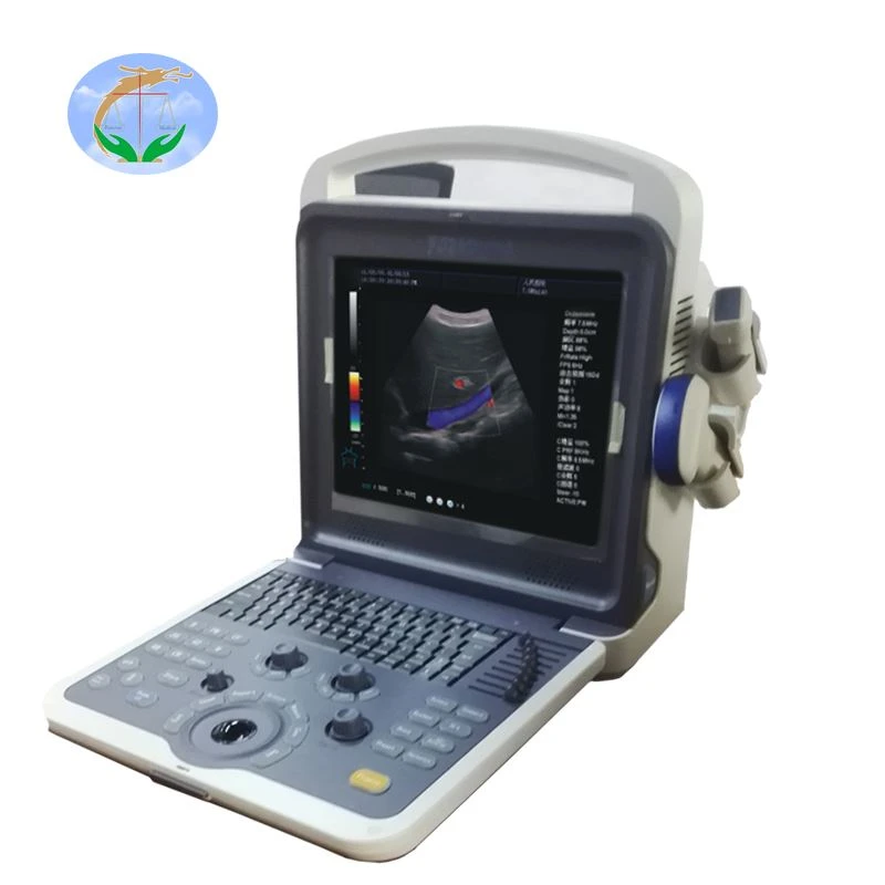 Doppler Color Ultrasound Machine Doppler Color Ultrasound Machine