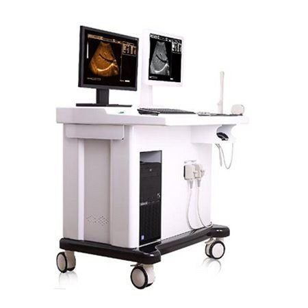YJ-U60T B&W Trolley Utrasound Scanner with Workstation