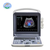Doppler couleur cardiaque portable 4D CW