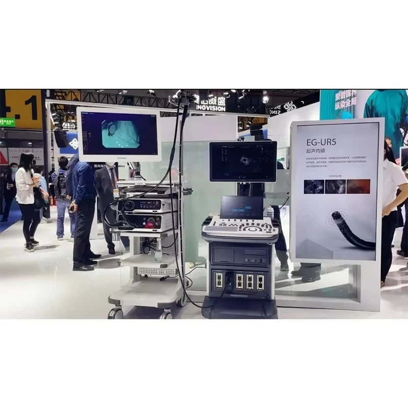 Sonoscape Eg Uc5 Endoscopic Ultrasound