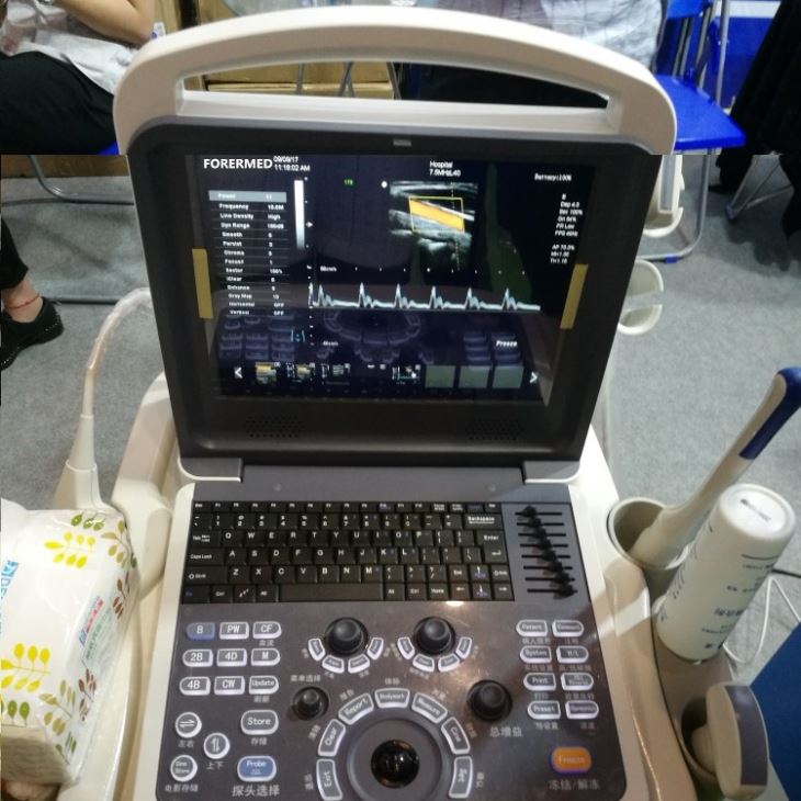 4D Notebook Color Ultrasound System Scanner 4D Notebook Color Ultrasound System Scanner