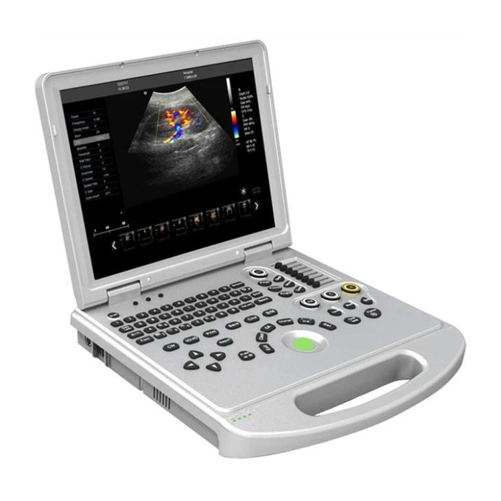Laptop Color Doppler Ultrasound