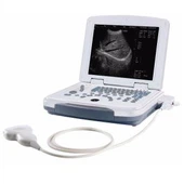 Scanner de système à ultrasons pour ordinateur portable N/B
