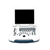 Système de diagnostic par ultrasons pour ordinateur portable B/W SGS