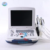 Scanner de système à ultrasons portable N/B