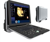 Échographie Doppler couleur portable haut de gamme