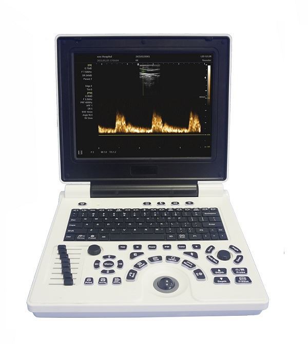Système de diagnostic par ultrasons Doppler couleur pour ordinateur portable