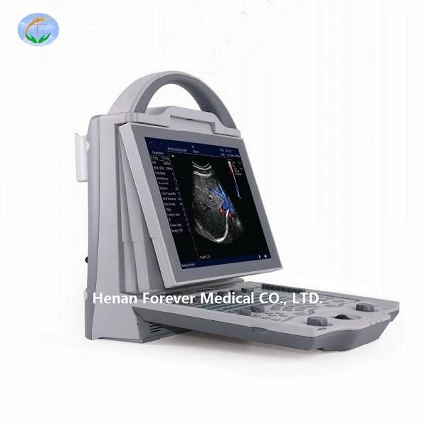 Système de diagnostic par ultrasons noir et blanc
