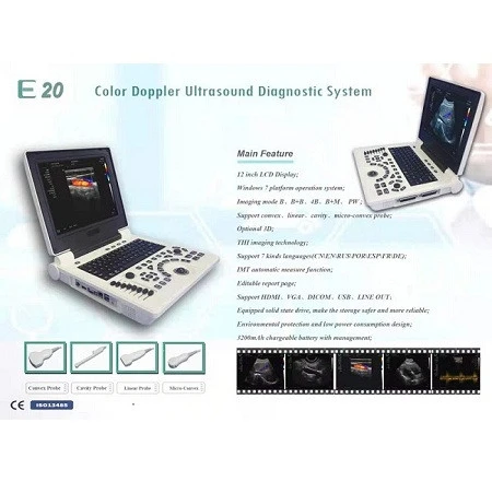 Laptop Color Doppler 3D Ultrasonic Diagnostic System Laptop Color Doppler 3D Ultrasonic Diagnostic System
